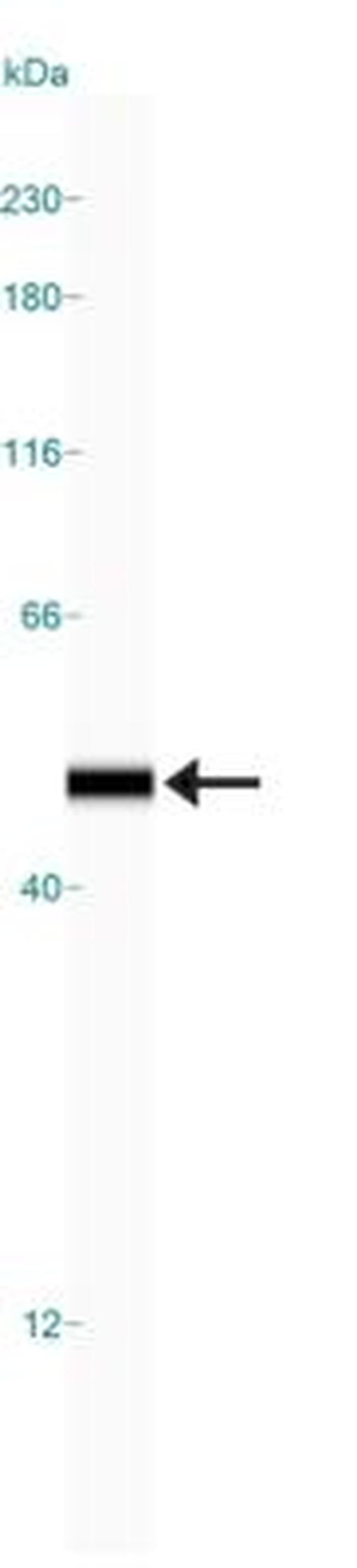 NSE Antibody in Western Blot (WB)