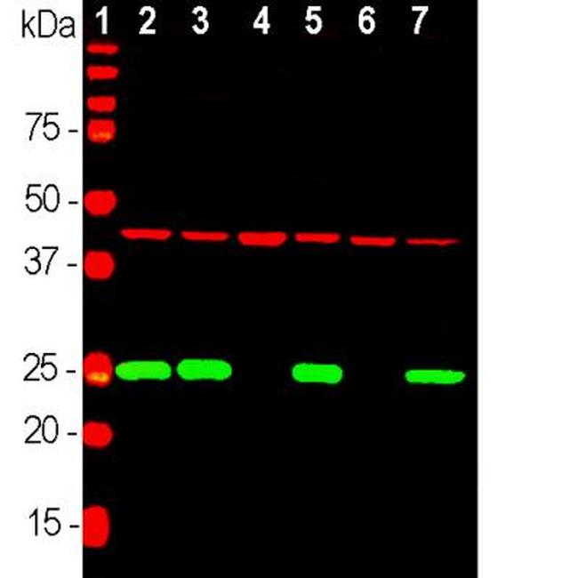 PGP9.5 Antibody in Western Blot (WB)