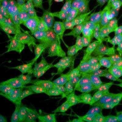 PGP9.5 Antibody in Immunocytochemistry (ICC/IF)