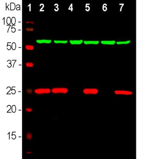 PGP9.5 Antibody in Western Blot (WB)