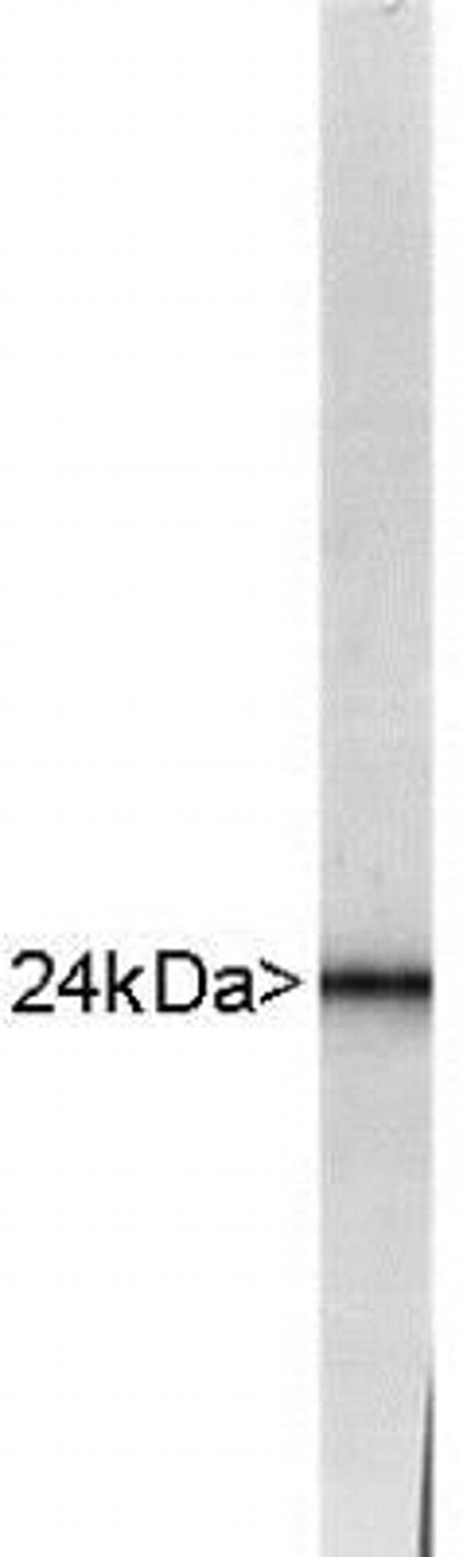 PGP9.5 Antibody in Western Blot (WB)