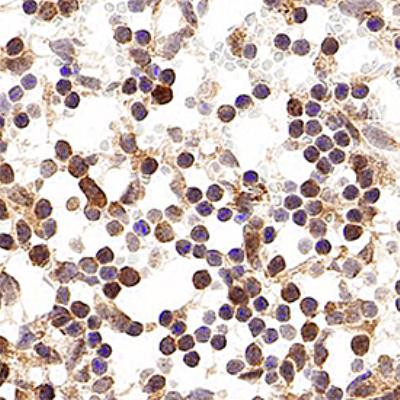 p16INK4a Antibody in Immunohistochemistry (Paraffin) (IHC (P))