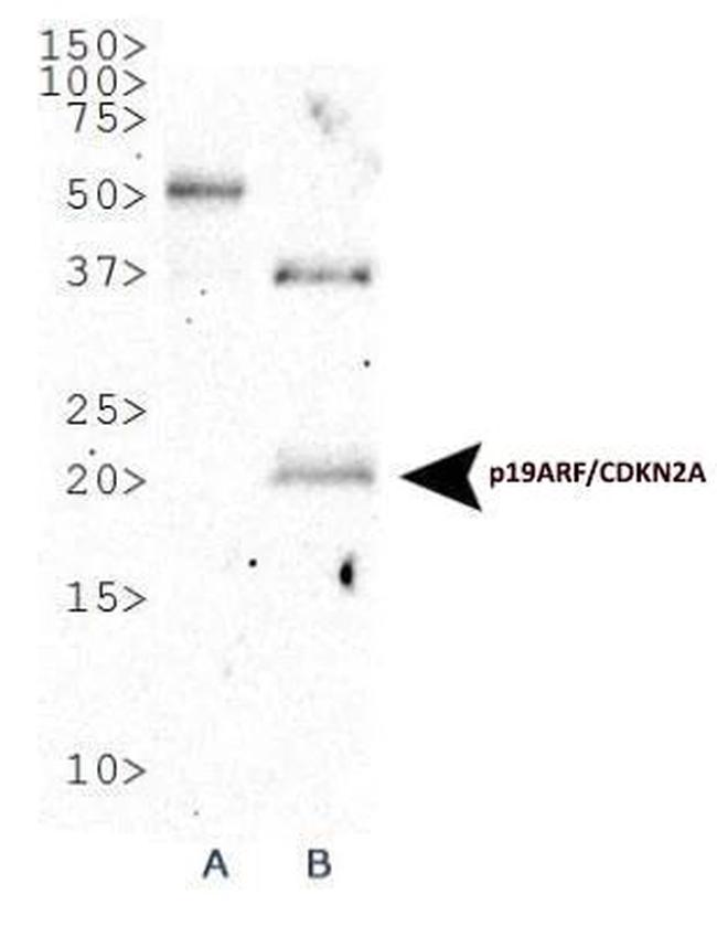 p16INK4a Antibody in Western Blot (WB)