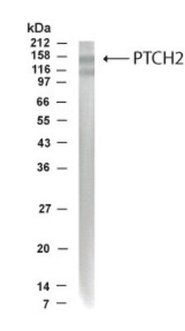 PTCH2 Antibody in Western Blot (WB)