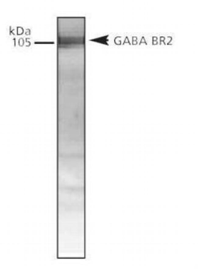 GABBR2 Antibody in Western Blot (WB)