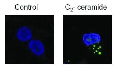 LC3B Antibody in Immunocytochemistry (ICC/IF)