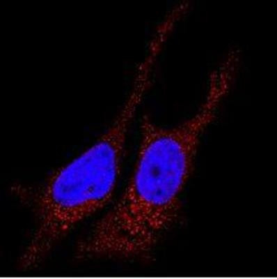 LC3B Antibody in Immunocytochemistry (ICC/IF)