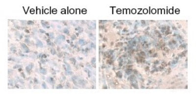 LC3B Antibody in Immunohistochemistry (Paraffin) (IHC (P))