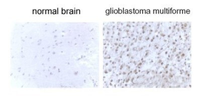 LC3B Antibody in Immunohistochemistry (Paraffin) (IHC (P))