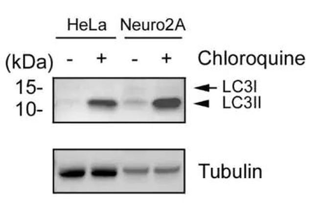 LC3B Antibody in Western Blot (WB)