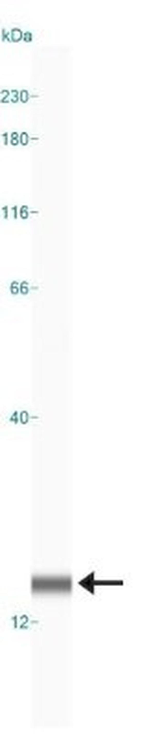 LC3B Antibody in Western Blot (WB)