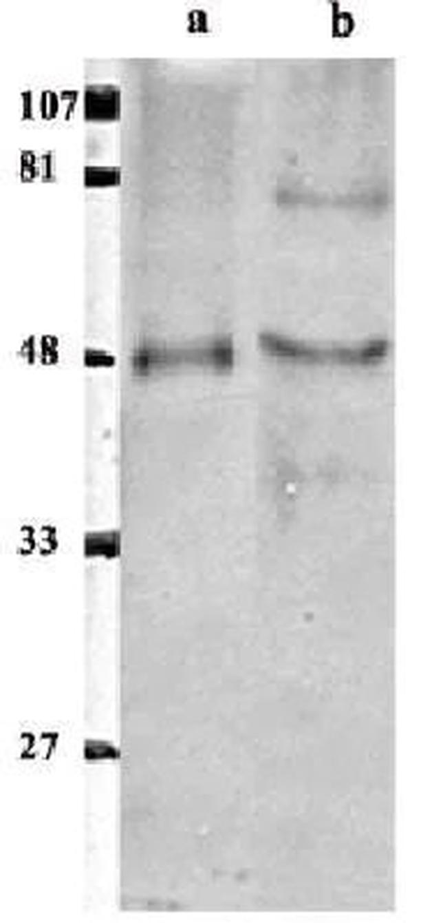 EAP2 Antibody in Western Blot (WB)