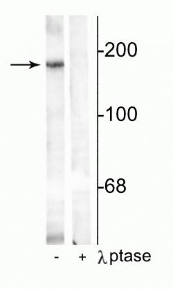 Phospho-NMDAR2B (Tyr1336) Antibody in Western Blot (WB)