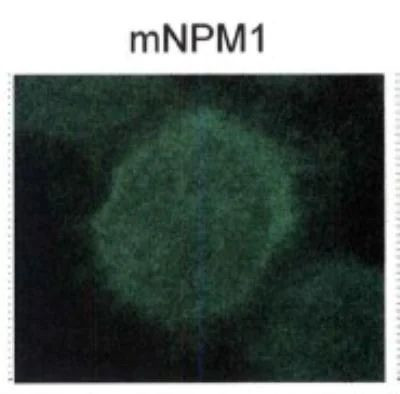 NPM1 (mutant) Antibody in Immunocytochemistry (ICC/IF)