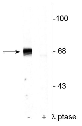 Phospho-PAK1/2/3 (Thr402) Antibody in Western Blot (WB)