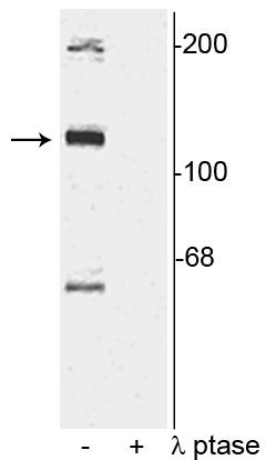 Phospho-TAOK2 (Ser181) Antibody in Western Blot (WB)