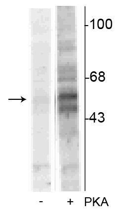 Phospho-TPH1 (Ser58) Antibody in Western Blot (WB)