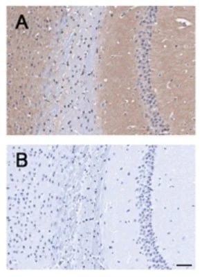 BAI1 Antibody in Immunohistochemistry (Paraffin) (IHC (P))