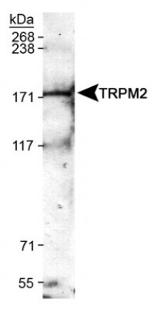 TRPM2 Antibody in Western Blot (WB)