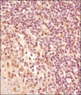 LMO2 Antibody in Immunohistochemistry (Paraffin) (IHC (P))