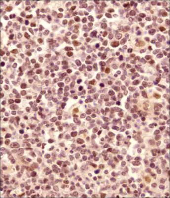 LMO2 Antibody in Immunohistochemistry (Paraffin) (IHC (P))