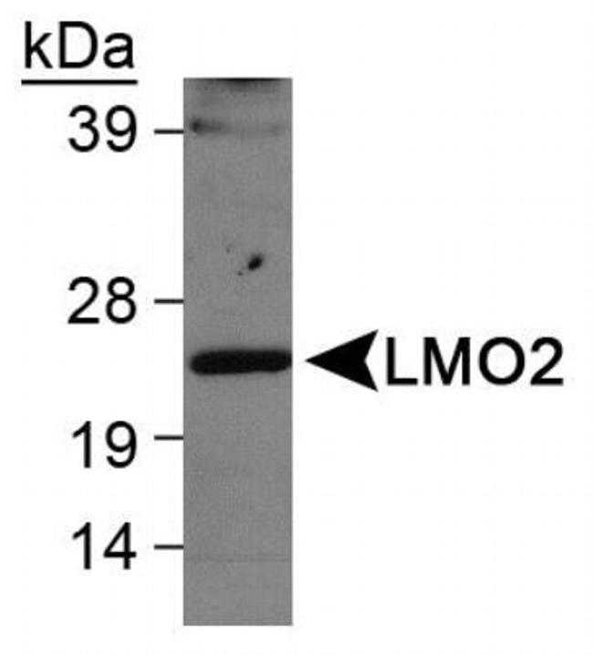 LMO2 Antibody in Western Blot (WB)