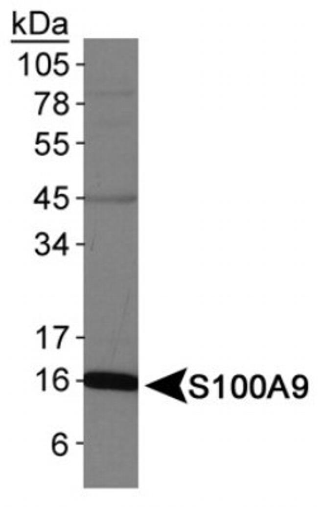 S100A9 Antibody in Western Blot (WB)