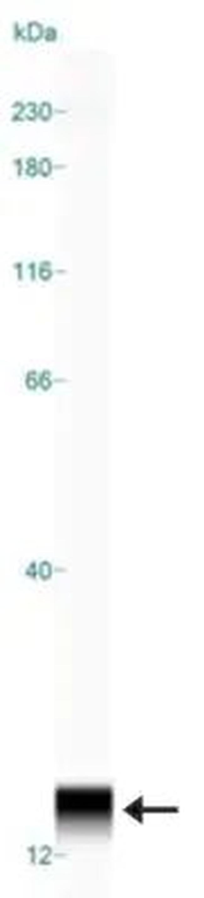 S100A9 Antibody in Western Blot (WB)