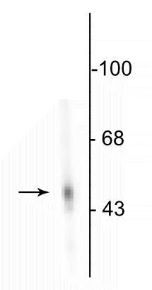 DOPA Decarboxylase Antibody in Western Blot (WB)