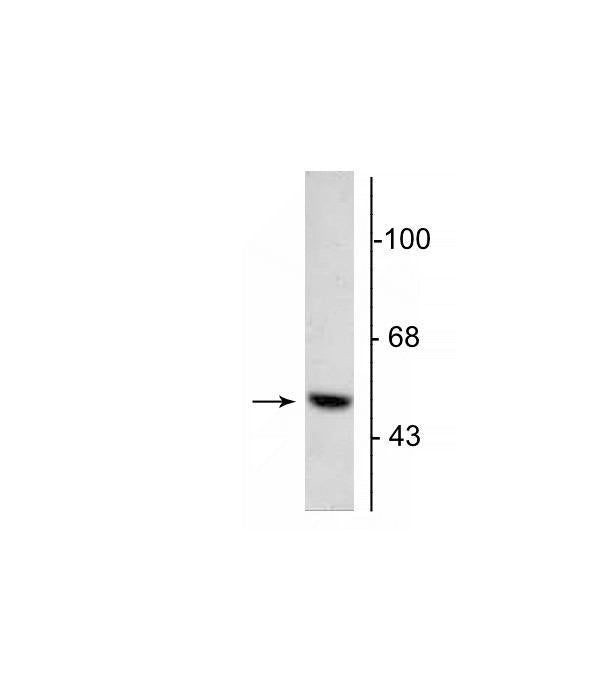 DOPA Decarboxylase Antibody in Western Blot (WB)