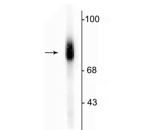 Dopamine beta Hydroxylase Antibody in Western Blot (WB)