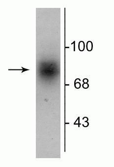 Dopamine Transporter Antibody in Western Blot (WB)