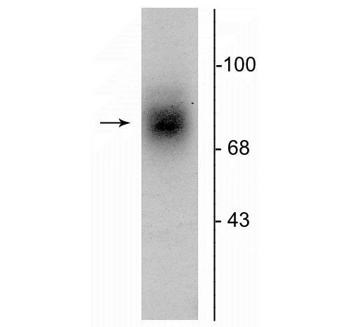 Dopamine Transporter Antibody in Western Blot (WB)