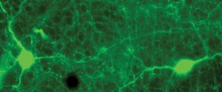 Tyrosine Hydroxylase Antibody in Immunohistochemistry (IHC)