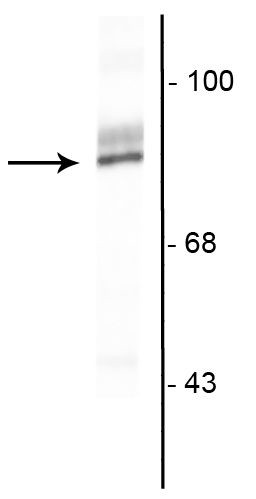 RSK3 Antibody in Western Blot (WB)