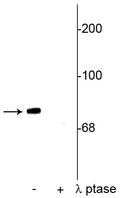 Phospho-Synapsin 1 (Ser549) Antibody in Western Blot (WB)