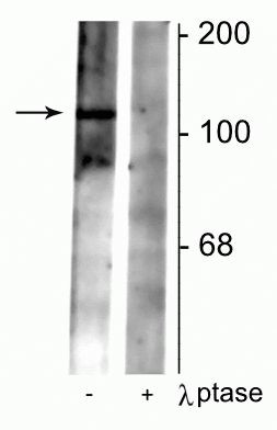 Phospho-GABBR2 (Ser783) Antibody in Western Blot (WB)