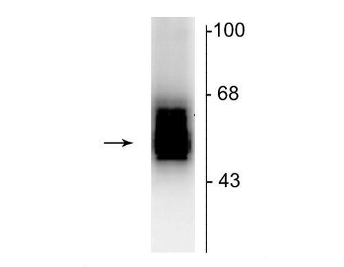 GABRB2 Antibody in Western Blot (WB)