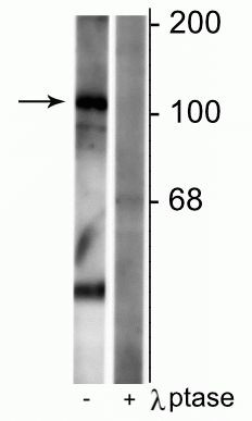 Phospho-GABBR1 (Ser923) Antibody in Western Blot (WB)