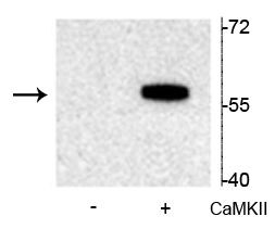 Phospho-TPH2 (Ser19) Antibody in Western Blot (WB)