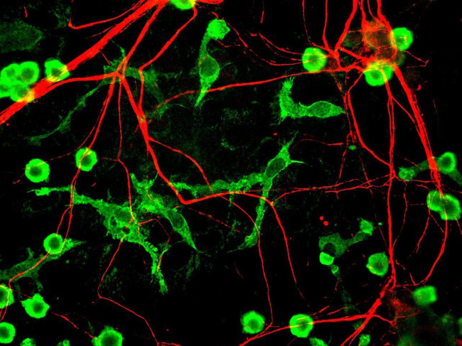 alpha Internexin Antibody in Immunocytochemistry (ICC/IF)