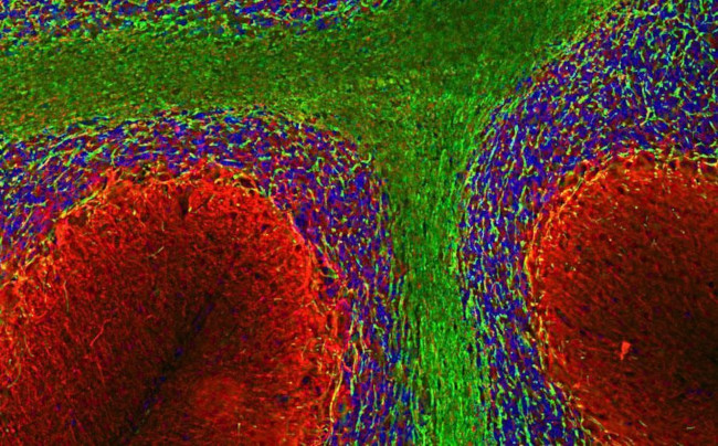 alpha Internexin Antibody in Immunohistochemistry (IHC)