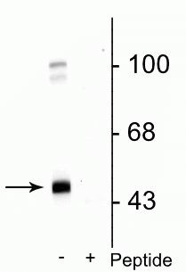 Phospho-GABRG2 (Ser327) Antibody in Western Blot (WB)