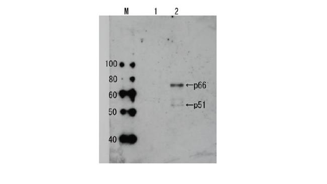 HIV1 Reverse Transcriptase Antibody in Western Blot (WB)