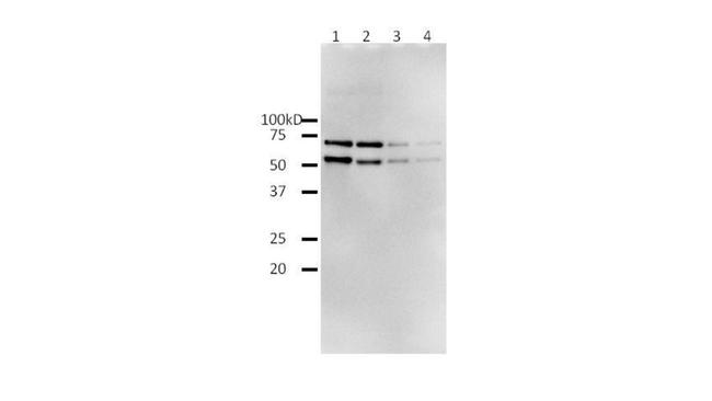 HIV1 Reverse Transcriptase Antibody in Western Blot (WB)