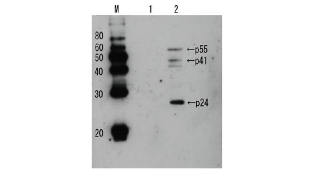 HIV1 p24 Antibody in Western Blot (WB)