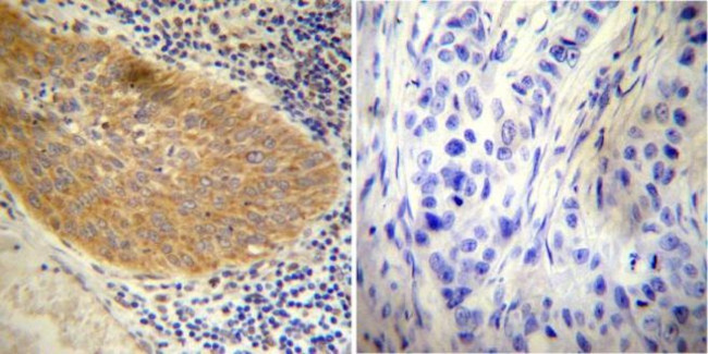 Glucocorticoid Receptor Antibody in Immunohistochemistry (Paraffin) (IHC (P))