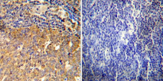 Glucocorticoid Receptor Antibody in Immunohistochemistry (Paraffin) (IHC (P))