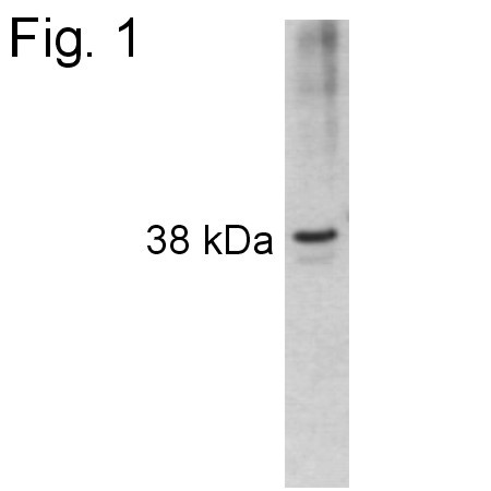 AIP Antibody in Western Blot (WB)