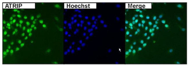 ATRIP Antibody in Immunocytochemistry (ICC/IF)